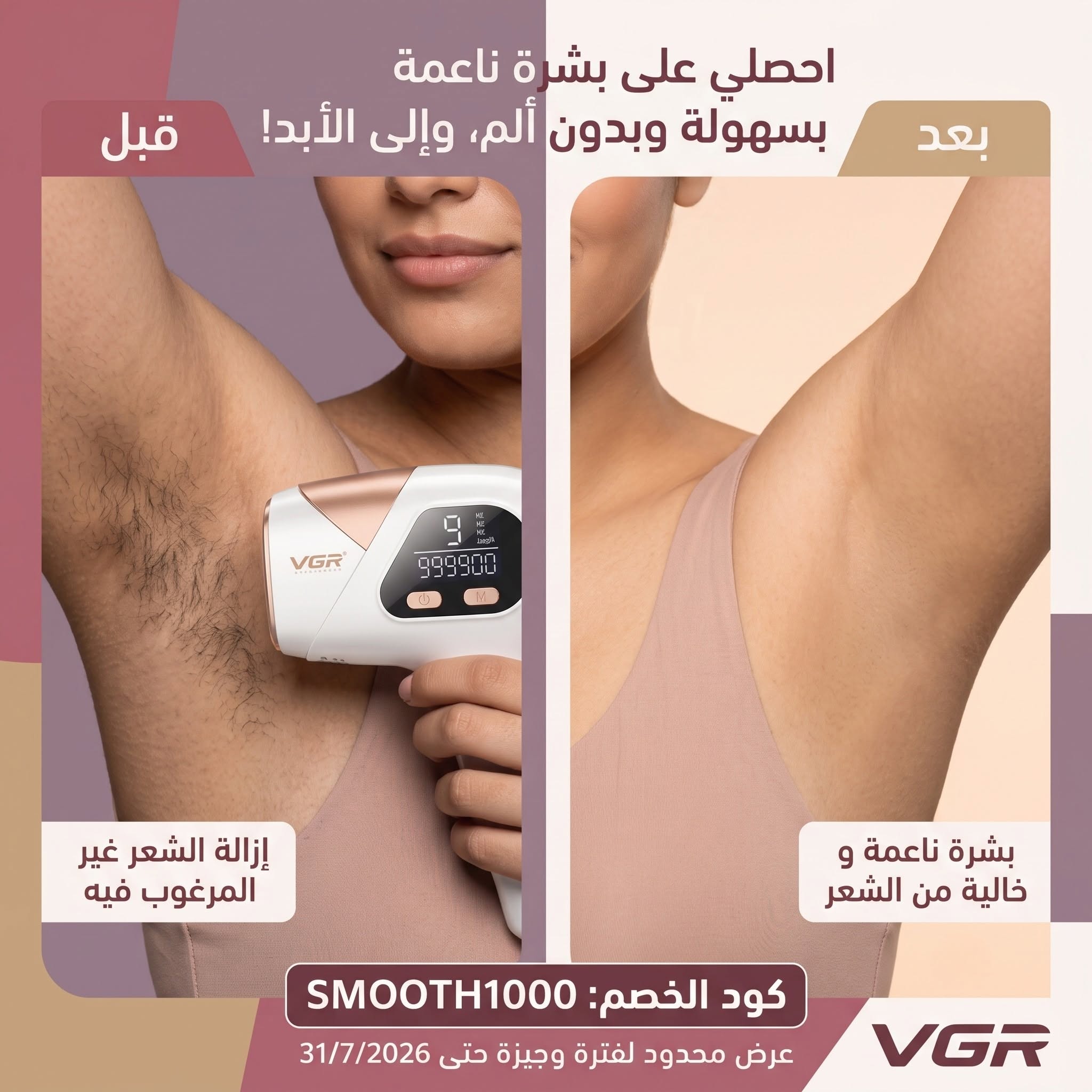 جهاز الليزر الأمريكي لإزالة الشعر مليون نبضة - الصورة 2